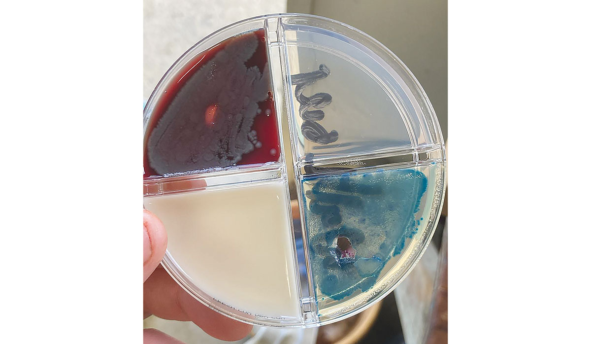 Serratia FBTW